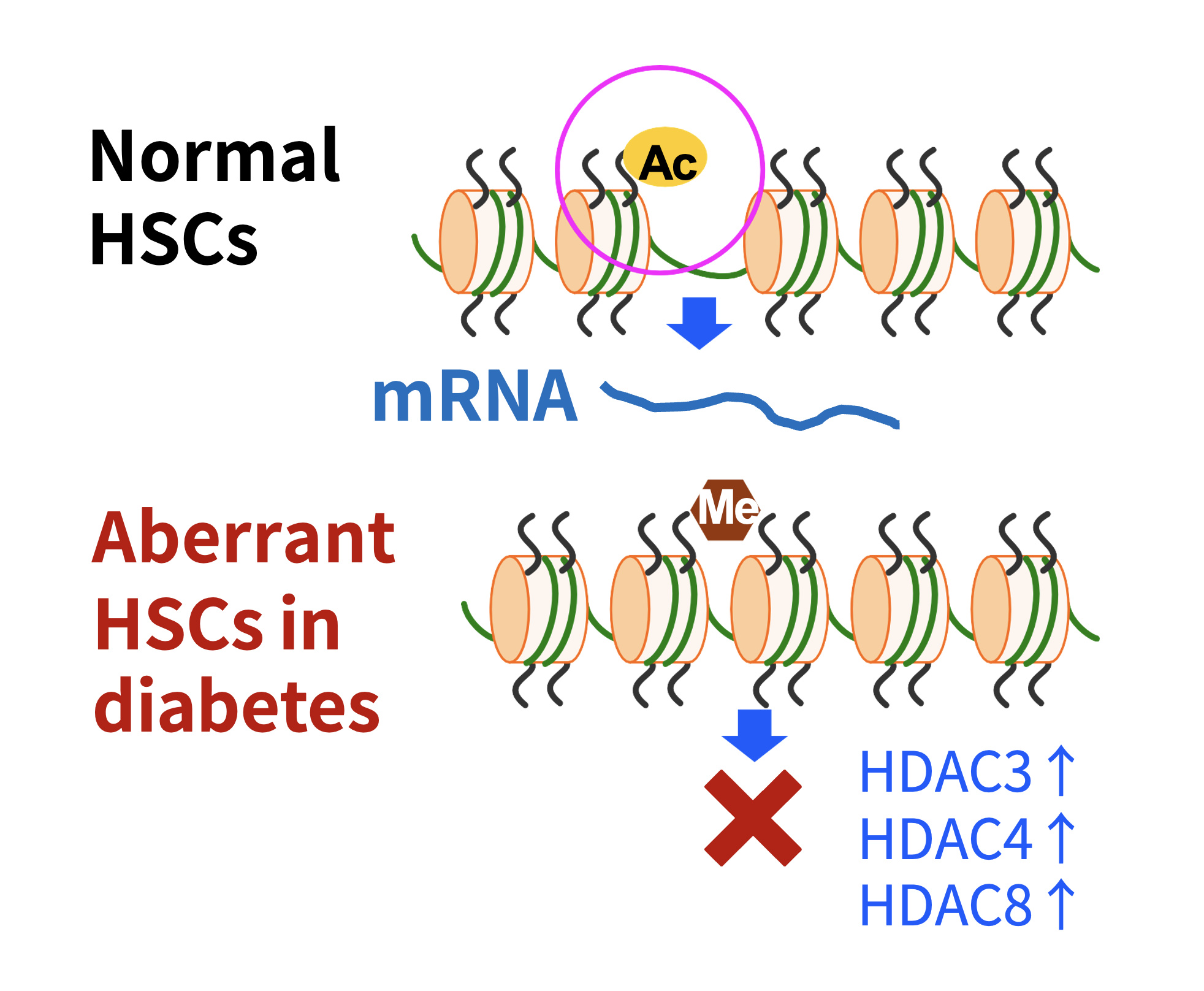 糖尿病ではHDACの異常な高発現を観察